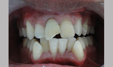 Dental clinic in Anand
                    